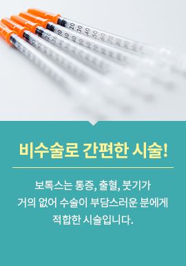 비수술로 간편한 시술