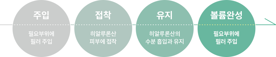 주입-접착-유지-볼륨완성